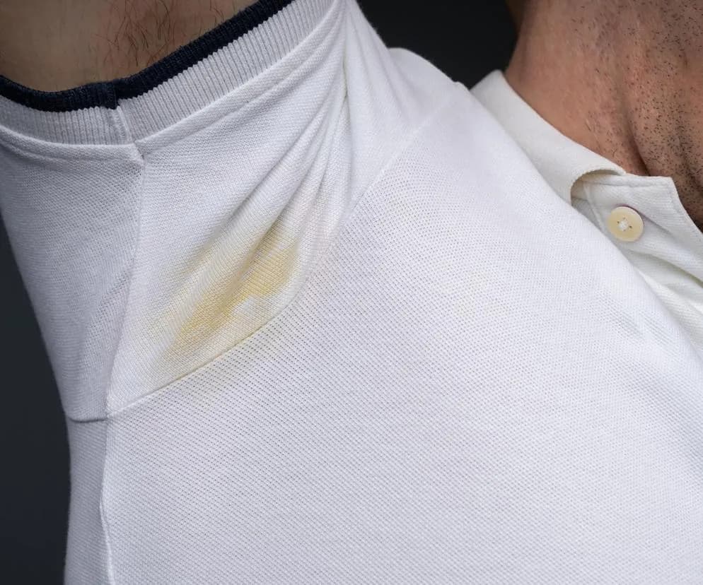 Jak usunąć żółtą plamę z białej bluzki? Skuteczne metody na plamy